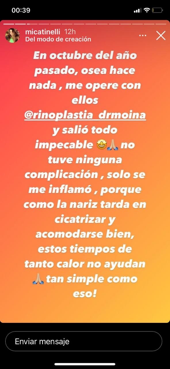 La explicación de Mica Tinelli tras su retoque estético.